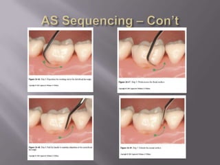 Area Specifics – Post. Sequencing
