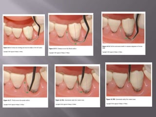 AS Sequencing – Con’t