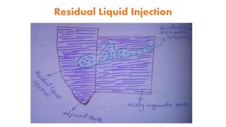 Residual Liquid Injection
 