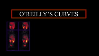 O’REILLY’S CURVES
 