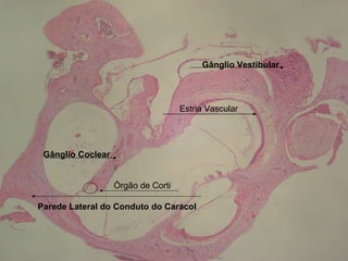 Gânglio Coclear  Gânglio Vestibular  Parede Lateral do Conduto do Caracol Estria Vascular Órgão de Corti 