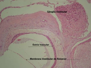 Gânglio Vestibular Membrana Vestibular de Reissner Estria Vascular 