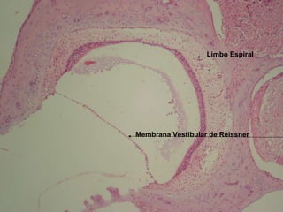 Membrana Vestibular de Reissner Limbo Espiral 