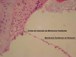 Membrana Vestibular de Reissner Crista de Inserção da Membrana Vestibular 