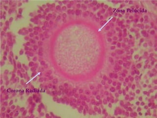 Zona Pelúcida




Corona Radiada
 
