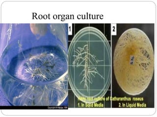 Root organ culture
 