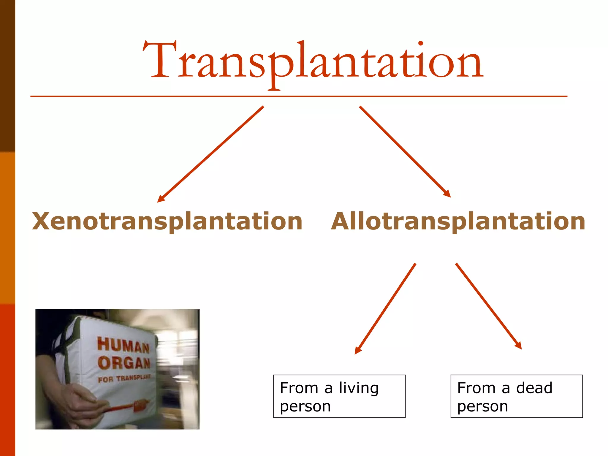 Transplantation   Allotransplantation Xen otransplantation From a living person From a dead person 