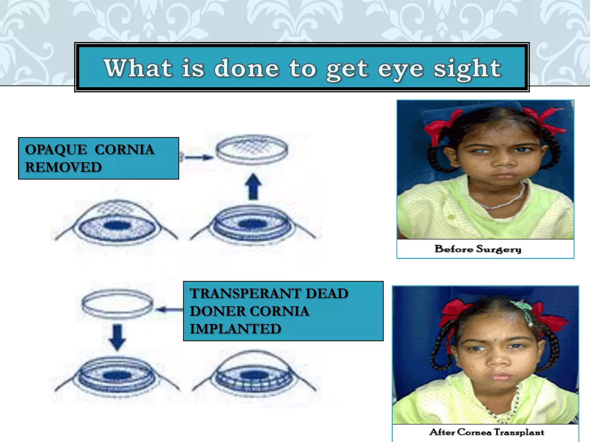 Organ donation english ppt