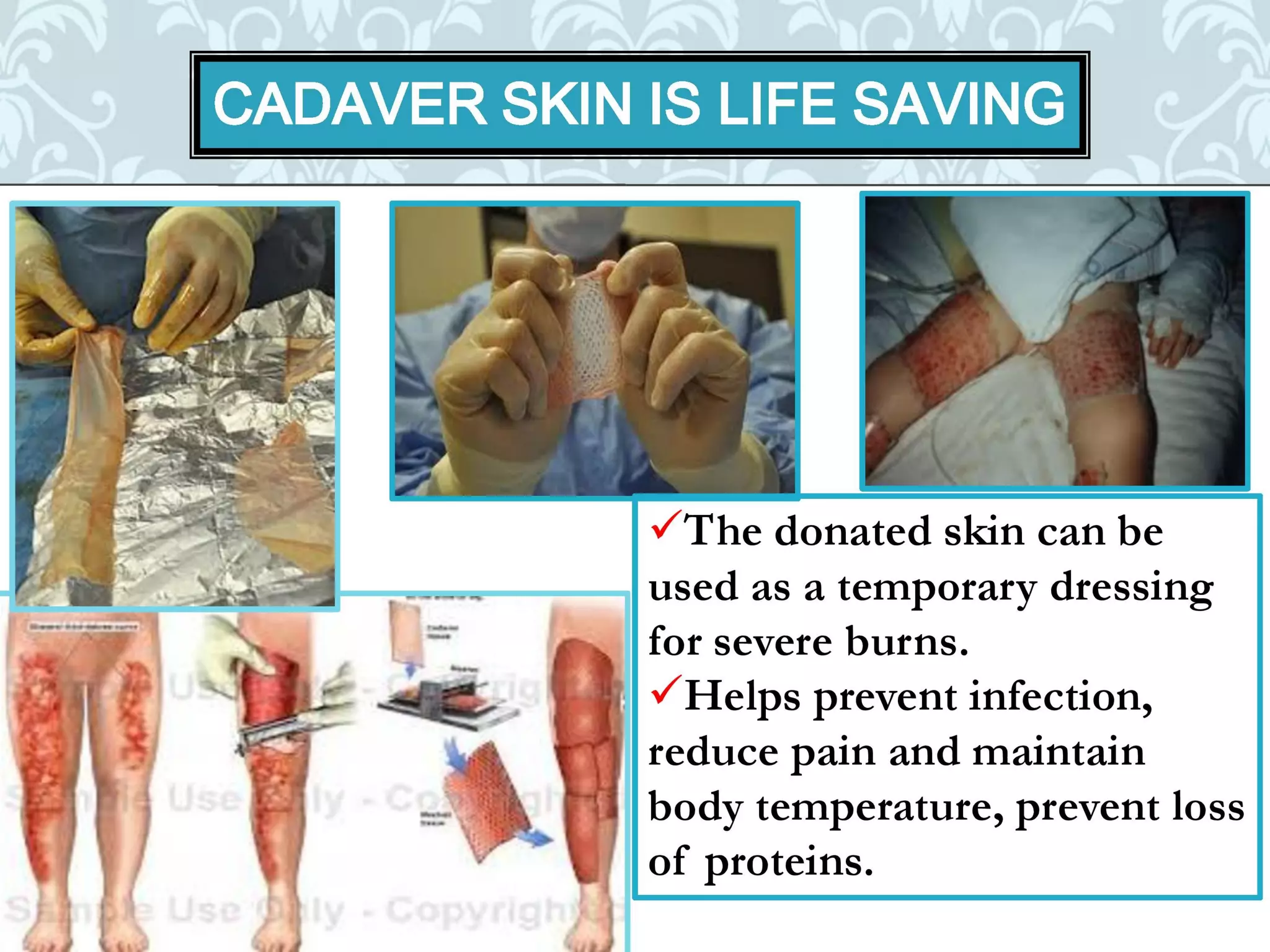 Organ donation english ppt