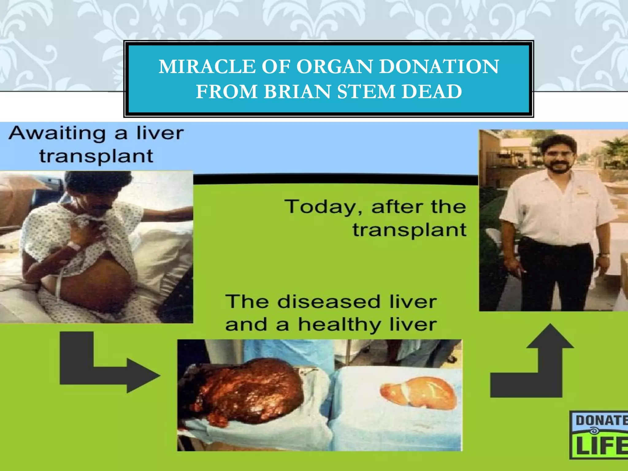 Organ donation english ppt