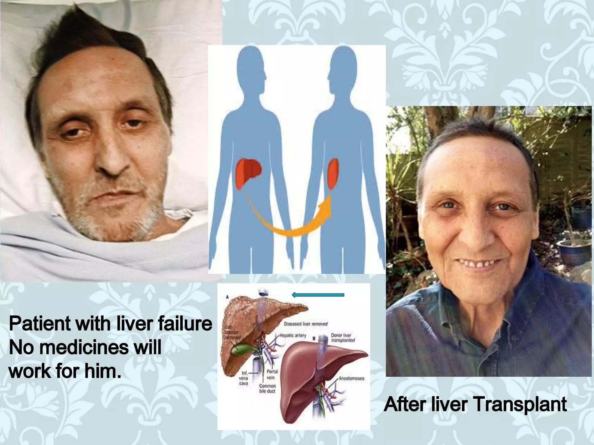 Organ donation english ppt