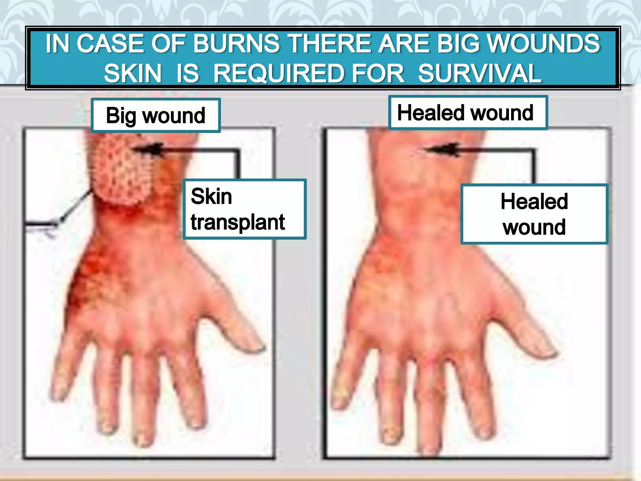 Organ donation english ppt