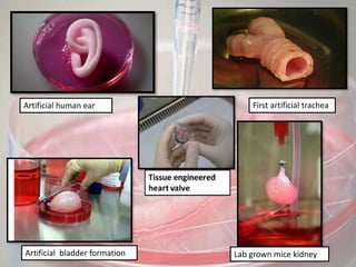 Artificial human ear First artificial trachea
Artificial bladder formation Lab grown mice kidney
 