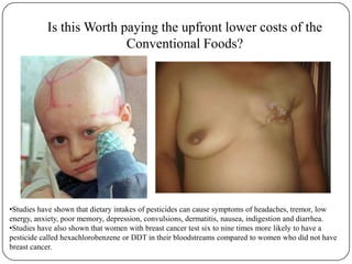 Is this Worth paying the upfront lower costs of the Conventional Foods?Studies have shown that dietary intakes of pesticides can cause symptoms of headaches, tremor, low energy, anxiety, poor memory, depression, convulsions, dermatitis, nausea, indigestion and diarrhea.  