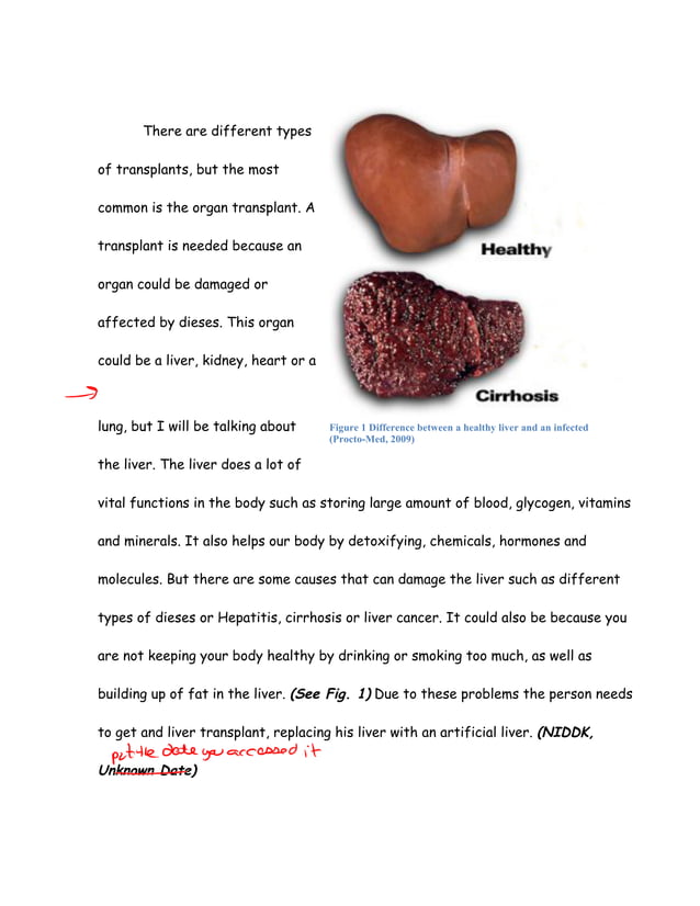 essay on role of liver