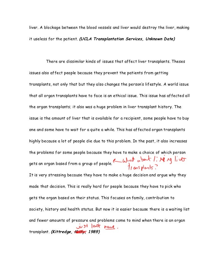 An Essay On Science Kittredge Mary After A Transplant An Essay On Health also Research Essay Topics For High School Students Liver Transplant Essay Sample Of An Essay Paper