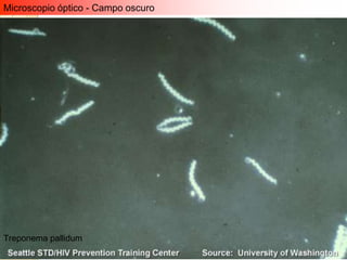 Microscopio óptico - Campo oscuro




Treponema pallidum
 