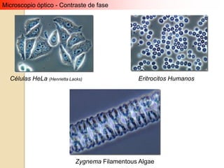 Microscopio óptico - Contraste de fase




  Células HeLa (Henrietta Lacks)                Eritrocitos Humanos




                             Zygnema Filamentous Algae
 