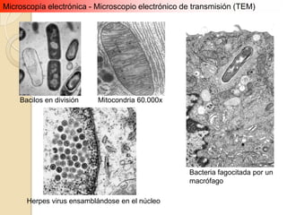 Microscopía electrónica - Microscopio electrónico de transmisión (TEM)




    Bacilos en división   Mitocondria 60.000x




                                                   Bacteria fagocitada por un
                                                   macrófago

      Herpes virus ensamblándose en el núcleo
 
