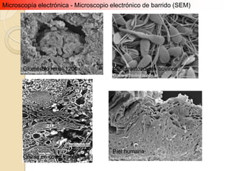 Microscopía electrónica - Microscopio electrónico de barrido (SEM)




       Glomérulo renal 1200x          Espermatozoides bovinos




                                      Piel humana
       Célula en corte transversal
 