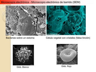 Microscopía electrónica - Microscopio electrónico de barrido (SEM)




    Bacterias sobre un estoma        Célula vegetal con cristales (falsa tinción)




             Glób. Blanco                           Glób. Rojo
 