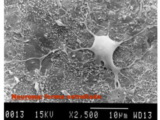 Neurona: forma estrellada