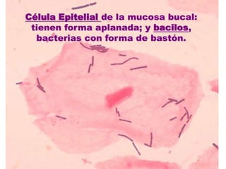 Célula Epitelial de la mucosa bucal: tienen forma aplanada; y bacilos, bacterias con forma de bastón. 