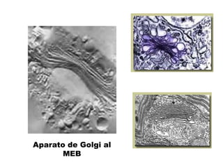 Aparato de Golgi al MEB