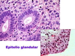 Epitelio glandular