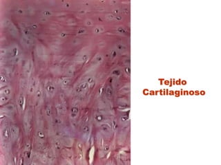 Tejido Cartilaginoso