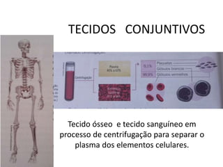 TECIDOS CONJUNTIVOS
Tecido ósseo e tecido sanguíneo em
processo de centrifugação para separar o
plasma dos elementos celulares.
 