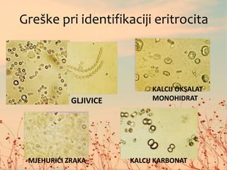 Organizirani sediment | PPT