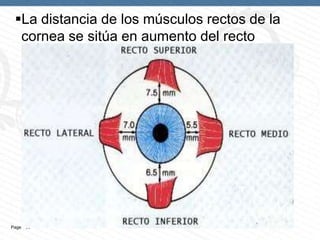La distancia de los músculos rectos de la
cornea se sitúa en aumento del recto
interno al recto

Page  30

 