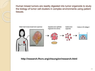 Human breast tumors are readily digested into tumor organoids to study
the biology of tumor cell clusters in complex envir...