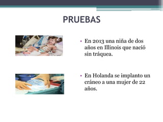 PRUEBAS
• En 2013 una niña de dos
años en Illinois que nació
sin tráquea.
• En Holanda se implanto un
cráneo a una mujer de 22
años.
 