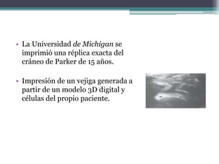 • La Universidad de Michigan se
imprimió una réplica exacta del
cráneo de Parker de 15 años.
• Impresión de un vejiga generada a
partir de un modelo 3D digital y
células del propio paciente.
 