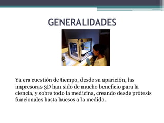 GENERALIDADES
Ya era cuestión de tiempo, desde su aparición, las
impresoras 3D han sido de mucho beneficio para la
ciencia, y sobre todo la medicina, creando desde prótesis
funcionales hasta huesos a la medida.
 