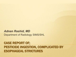 CASE REPORT OF;
PESTICIDE INGESTION, COMPLICATED BY
ESOPHAGEAL STRICTURES
Adnan Rashid, MD
Department of Radiology SIMS/SHL
 