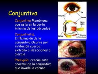 Conjuntiva
Conjuntiva Membrana
que está en la parte
interna de los párpados
Conjuntivitis.
Inflamación de la
conjuntiva Ocurre por
irritación cuerpo
extraño o infecciones o
alergia
Pterigión: crecimiento
anormal de la conjuntiva
que invade la córnea
 