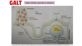 GALT Tejido linfoide asociado al intestino
 