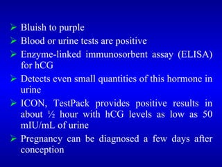  Bluish to purple
 Blood or urine tests are positive
 Enzyme-linked immunosorbent assay (ELISA)
for hCG
 Detects even small quantities of this hormone in
urine
 ICON, TestPack provides positive results in
about ½ hour with hCG levels as low as 50
mIU/mL of urine
 Pregnancy can be diagnosed a few days after
conception
 