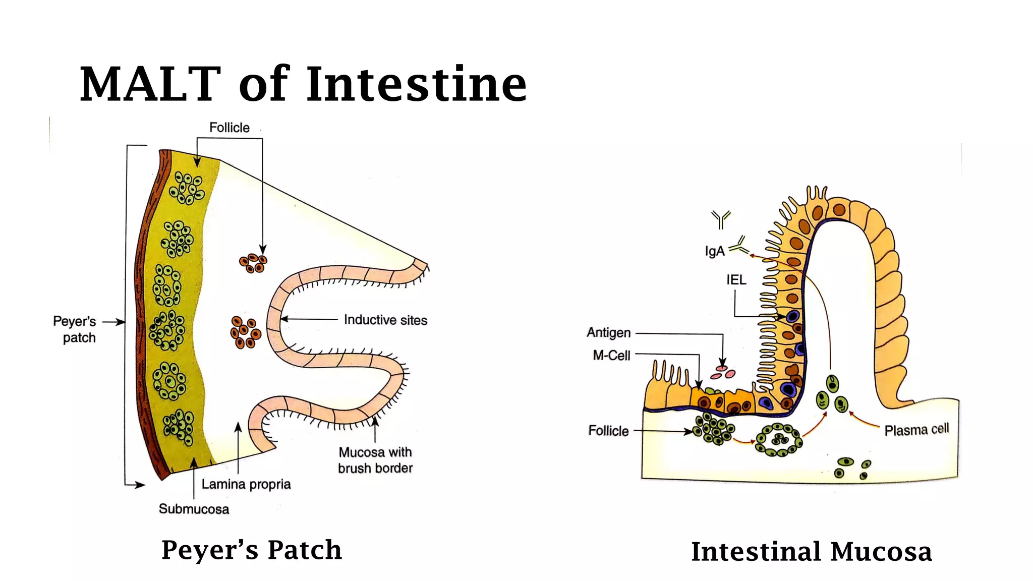 MALT of Intestine
Peyer’s Patch Intestinal Mucosa
 