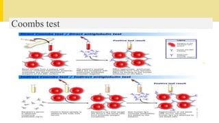 Coombs test
 