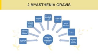 2,MYASTHENIA GRAVIS
 