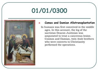 01/01/0300 
Comos and Damian Allotransplantation 
In humans was first conceived in the middle 
ages. In this account, the leg of the 
sacristan Deacon Justinian was 
amputated to treat a cancerous lesion. 
Cosmos and Damian, twin Arab brothers 
who were converts to Christianity 
performed the operations. 
 