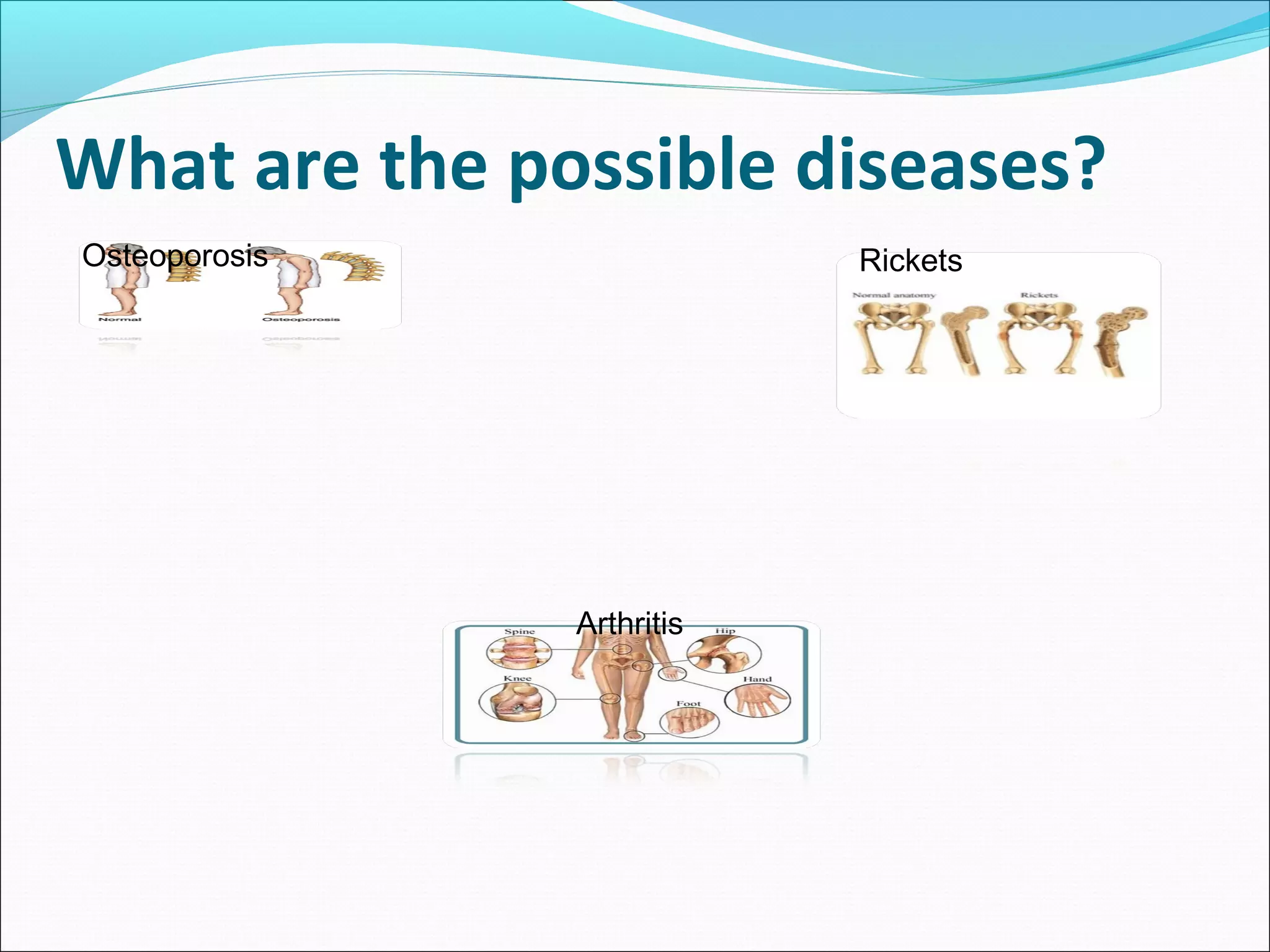 What are the possible diseases?
Osteoporosis

Rickets

Arthritis

 