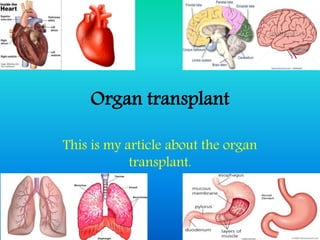 Organ transplant
This is my article about the organ
transplant.
 
