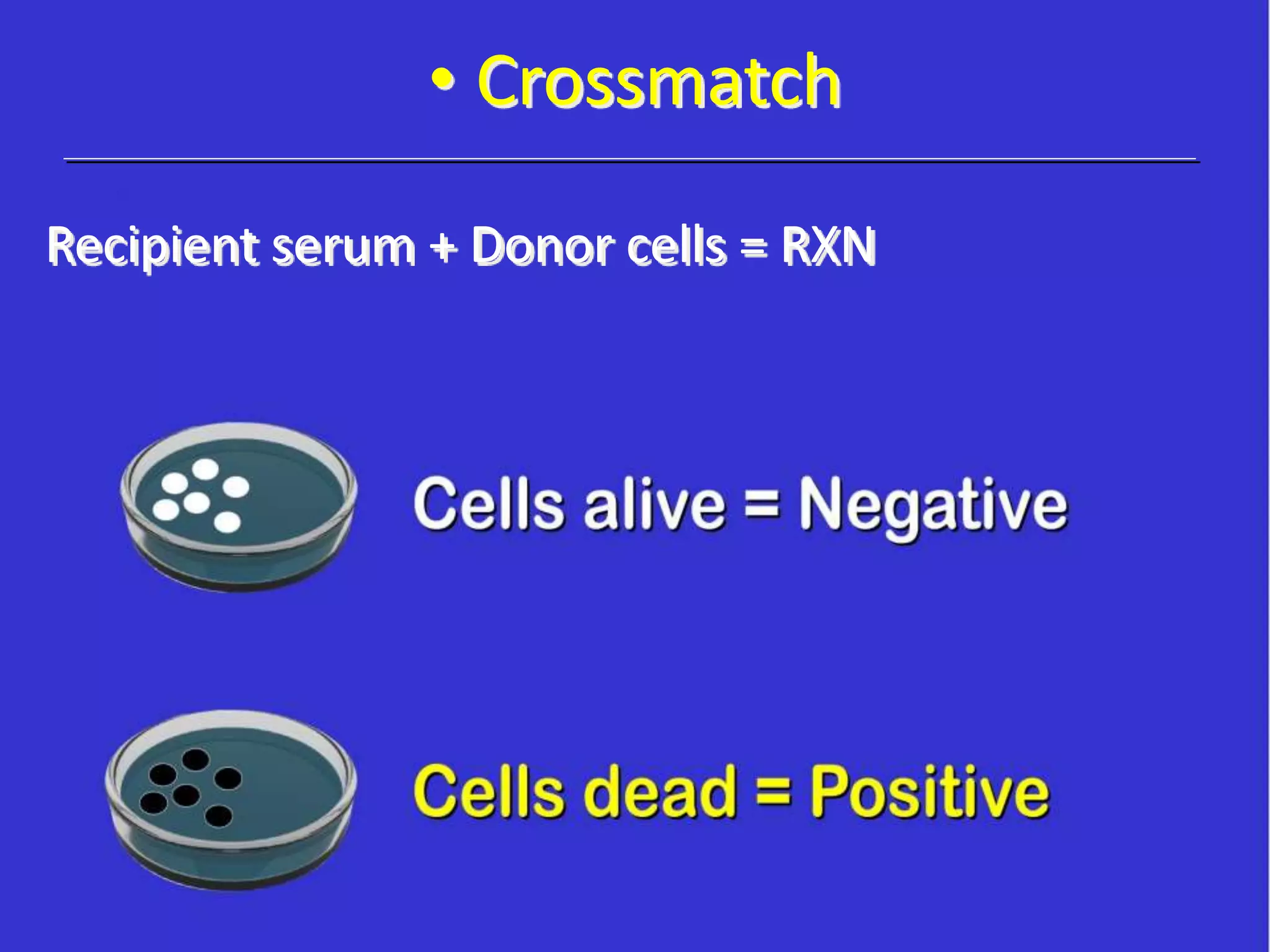• Crossmatch
Recipient serum + Donor cells = RXN
 