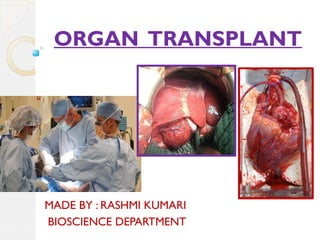 ORGAN TRANSPLANT
MADE BY : RASHMI KUMARI
BIOSCIENCE DEPARTMENT
 