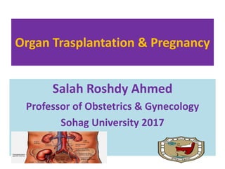 Organ Trasplantation & Pregnancy
Salah Roshdy Ahmed
Professor of Obstetrics & Gynecology
Sohag University 2017
 